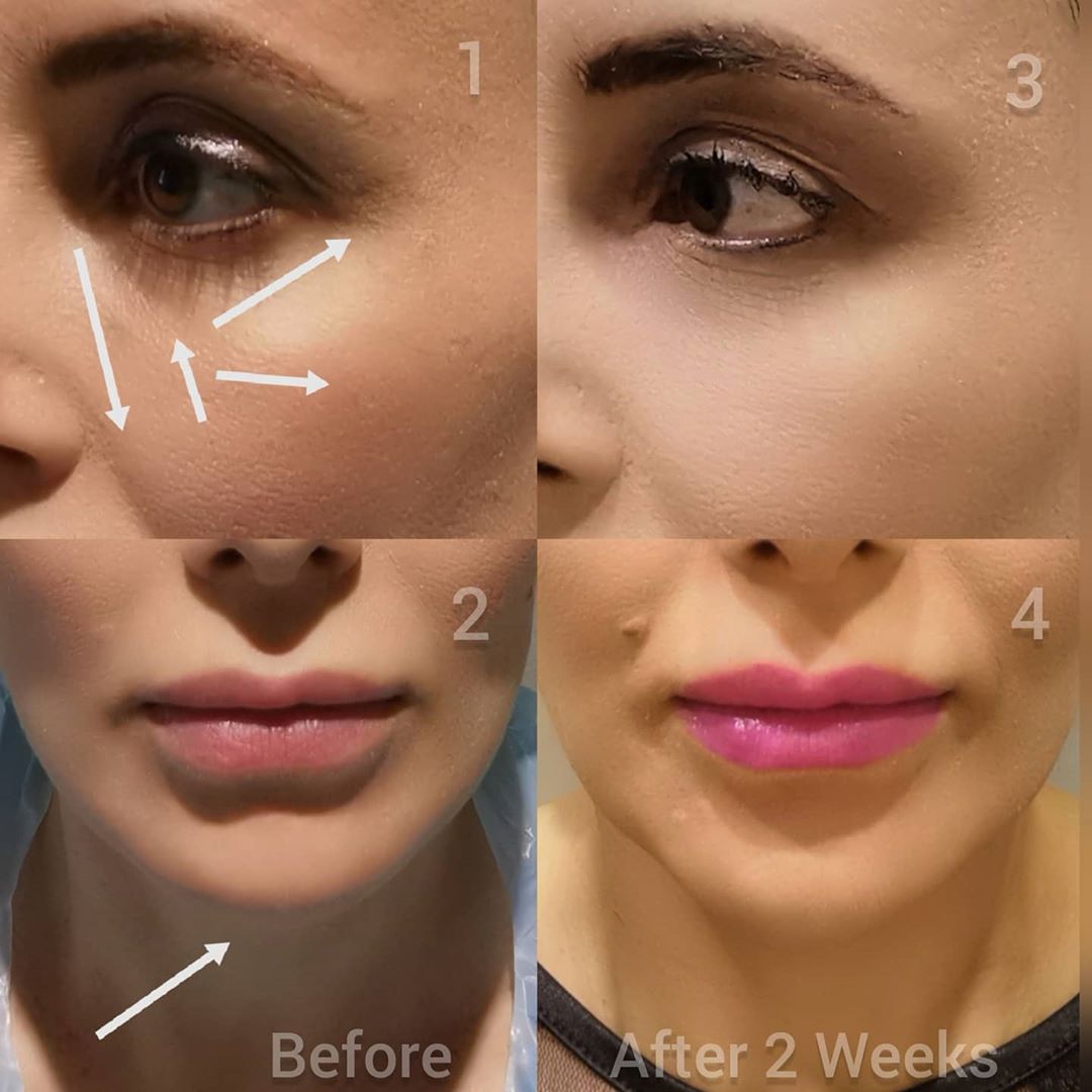 Dr Giorgia Ratta - before and after treatment image
