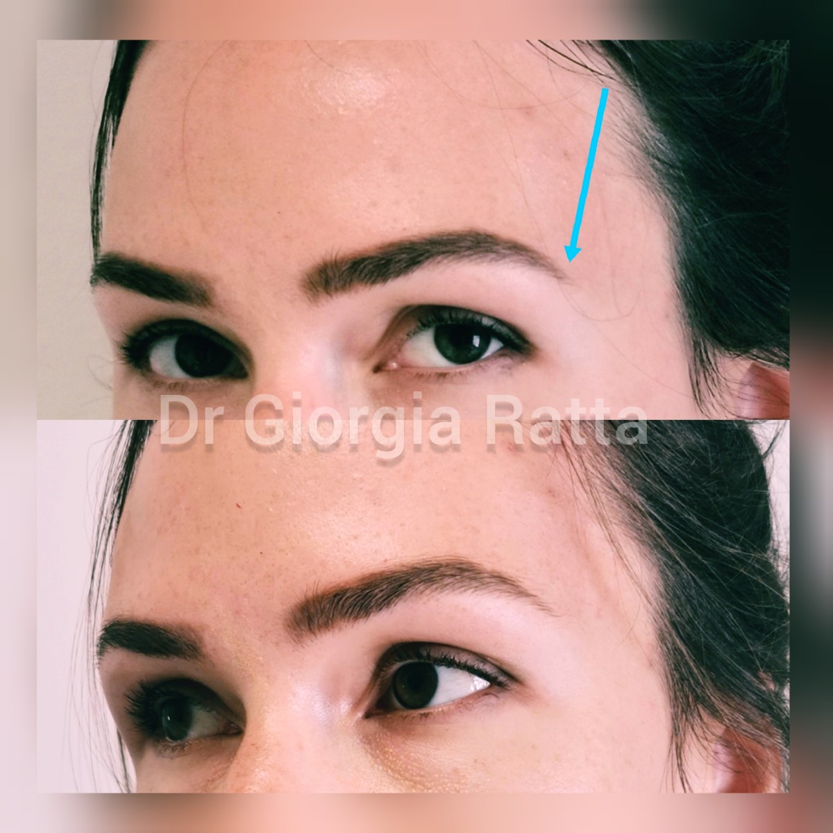 Dr Giorgia Ratta - before and after treatment image