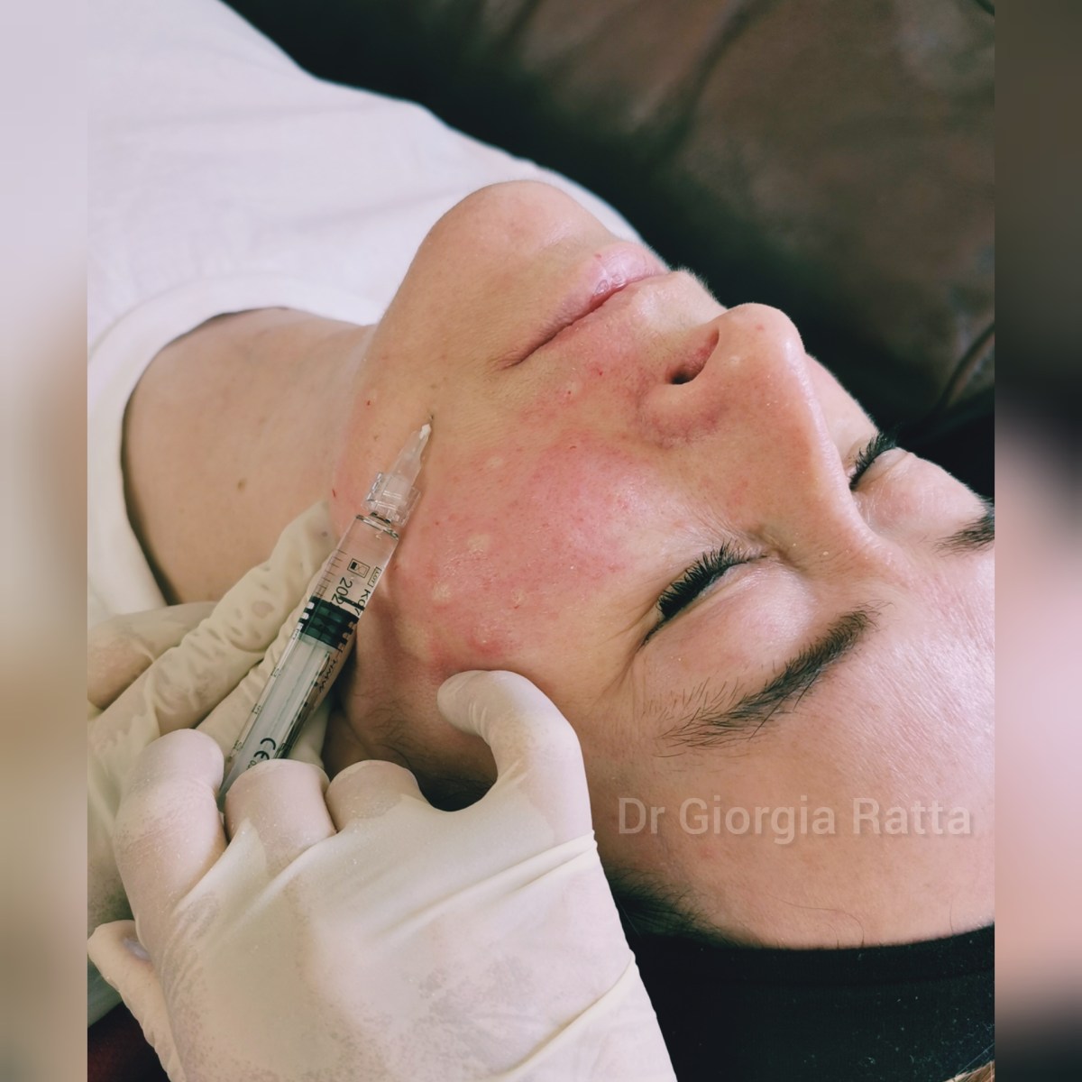 Dr Giorgia Ratta - before and after treatment image