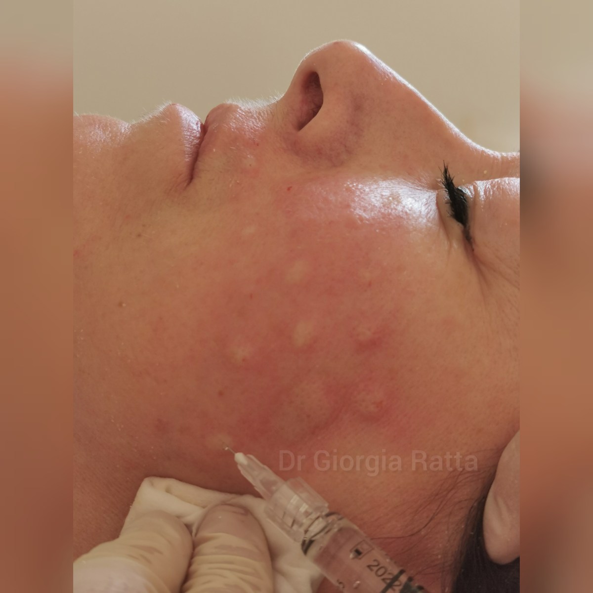 Dr Giorgia Ratta - before and after treatment image