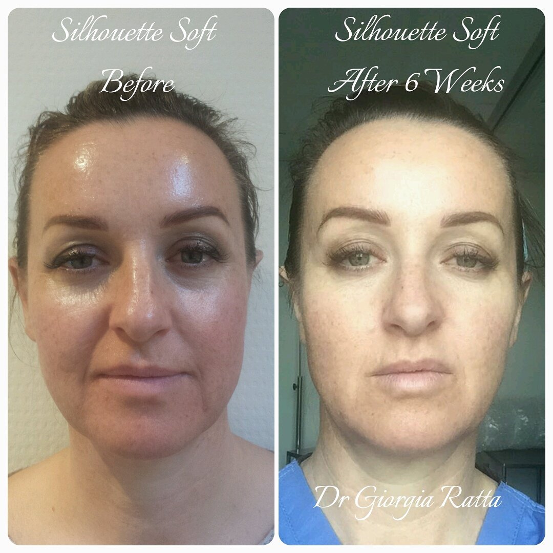 Dr Giorgia Ratta - before and after treatment image