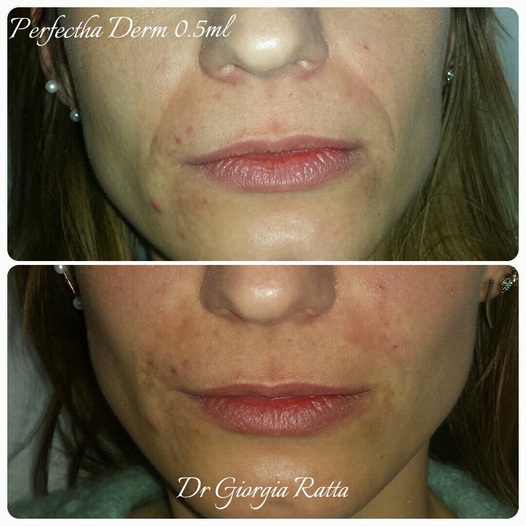 Dr Giorgia Ratta - before and after treatment image