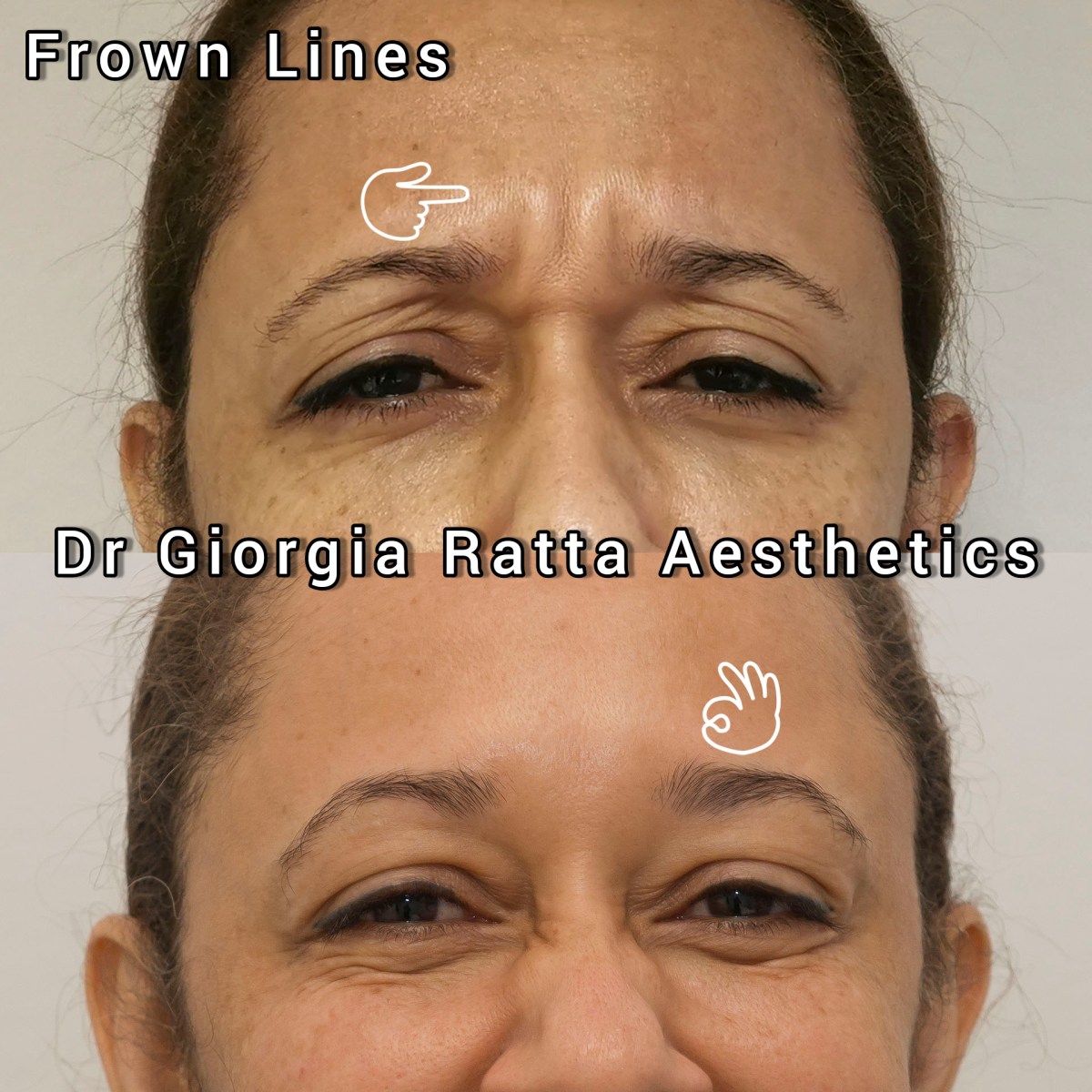 Dr Giorgia Ratta - before and after treatment image