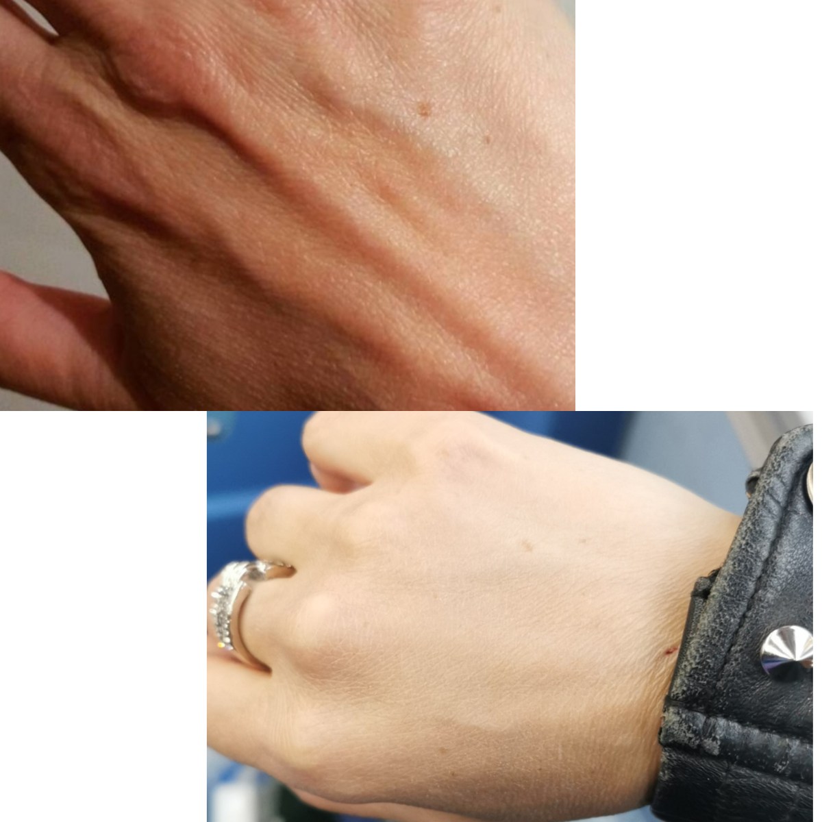 Dr Giorgia Ratta - before and after treatment image