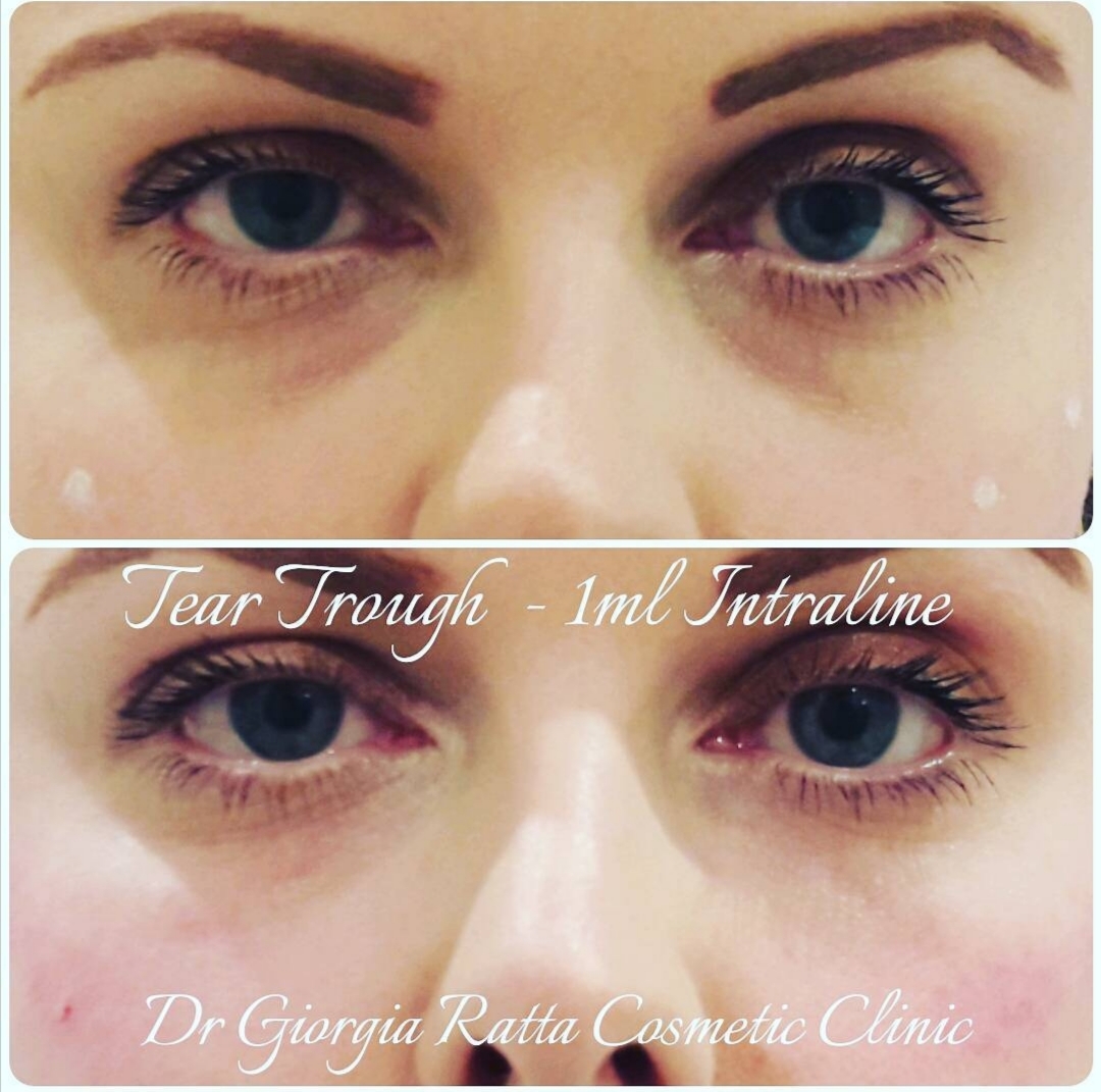 Dr Giorgia Ratta - before and after treatment image